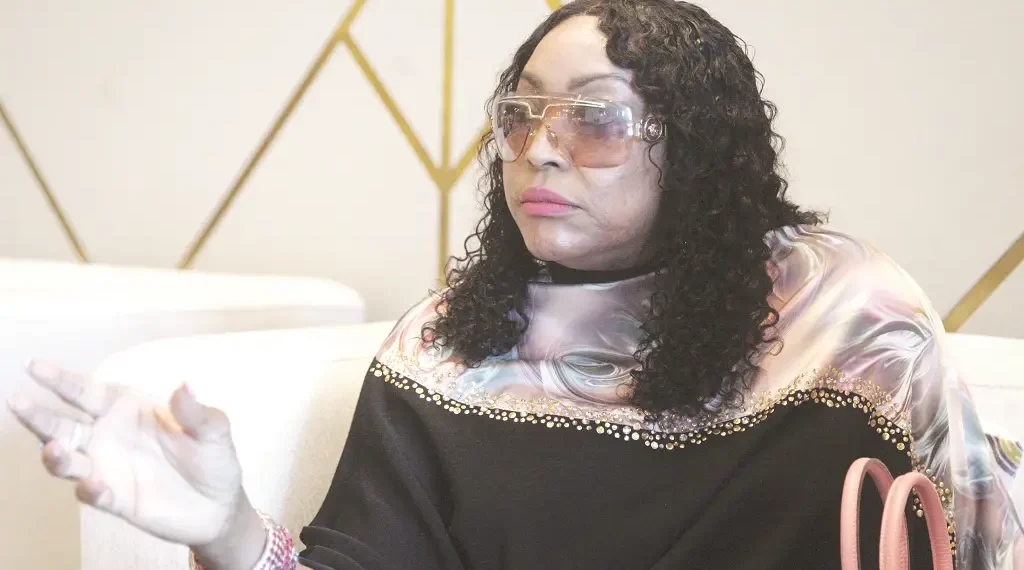 “O que é bom para os estrangeiros tem que ser bom para os nacionais”